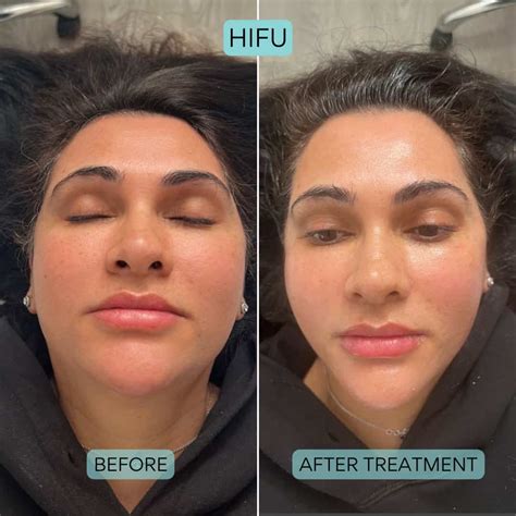 Souirensu It Works: See the Amazing Before & After Results - m2w7gub