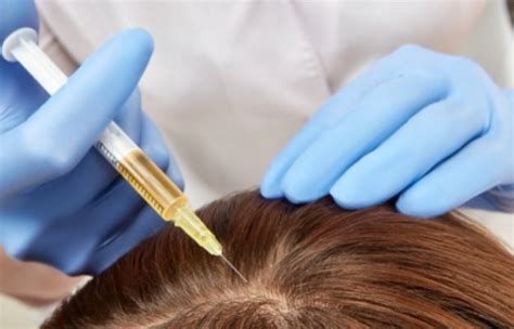 Rejuvenate Your Hair with PRP Hair Loss Treatment | Medical Hair