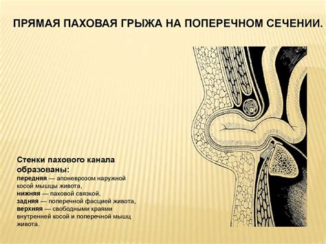 Грыжи живота - презентация онлайн