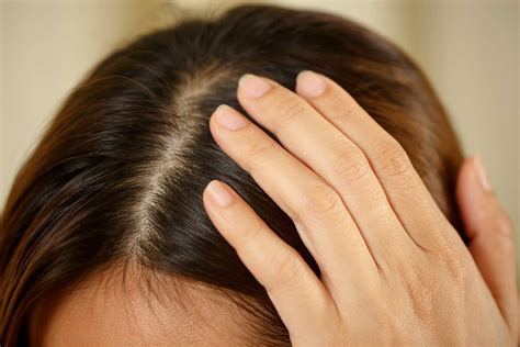 Do You Need SPF for Your Scalp? Here's Everything You Should Know 