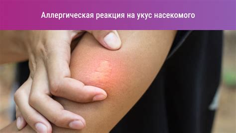 Аллергия на лице: всё о причинах и лечении
