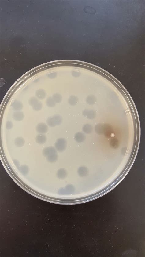 The Actinobacteriophage Database | Phage Aella