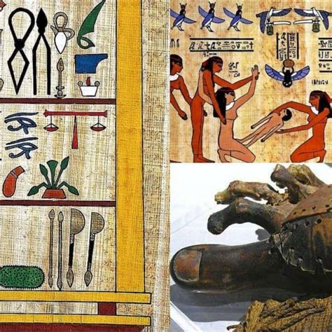 ancient Egyptian medicine | Ancient egyptian medicine, Ancient egyptian ...