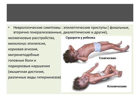 Синдром MELAS - презентация онлайн