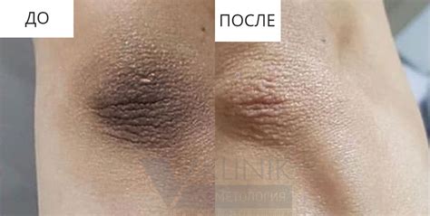 Интимное отбеливание - В Клиник, пространство красоты и здоровья - В-КЛИНИК