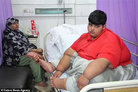 worlds fattest child  weighs st   years  set