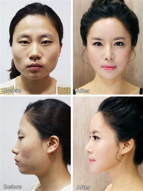 Korean Plastic Surgery. Part 2 (61 pics)