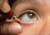 conditions eye drops eugene eye care