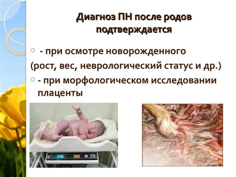 Плацентарная недостаточность - презентация онлайн