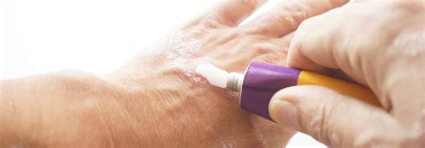 effective corticosteroids treatments benefits side effects