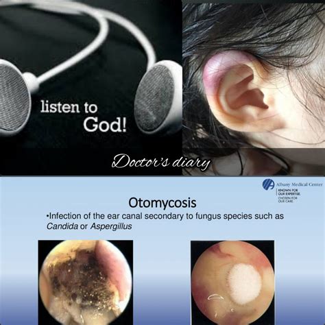 singapore ears doctors diary