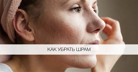 Как убрать шрам на лице? - Я Покупаю