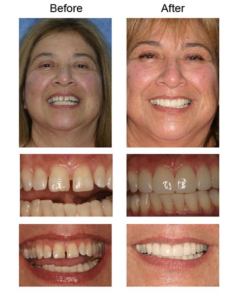 cosmetic dentistry grants review dental news network
