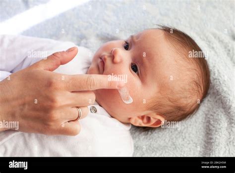 Baby mit atopischer Dermatitis immer Creme gelegt. Pflege und ...