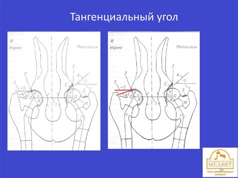 Рентгенология. Кости - презентация онлайн