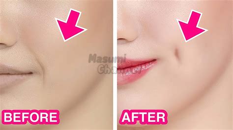 5mins Dimples Exercise! Simple Facial Exercises to get Dimples without ...