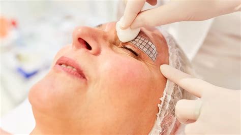 learn    types  eyelid surgery