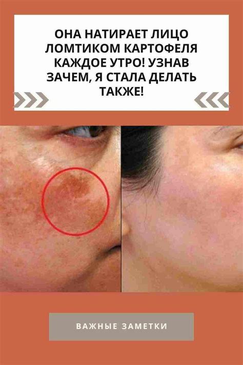 Она натирает лицо ломтиком картофеля каждое утро! Узнав зачем, я стала ...