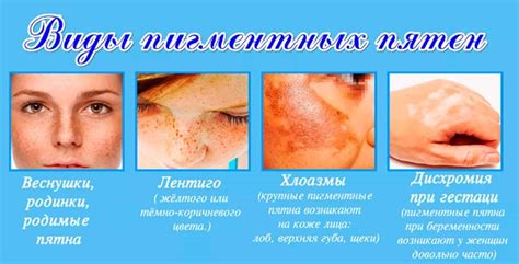 Средство от пигментных пятен на лице, руках. Лучшие народные рецепты ...