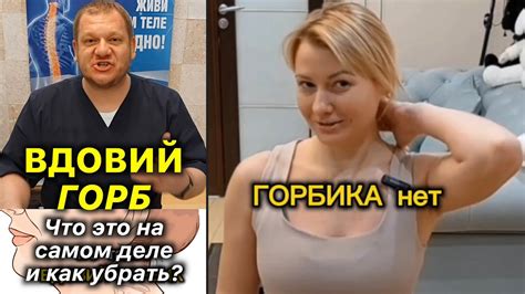 Вдовий Горб ️Что Это На Самом Деле? Как убрать холку #холка #вдовийгорб ...