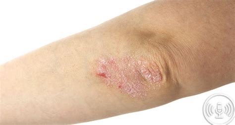 From alopecia to zits: skin directory aims to educate public | Aged ...
