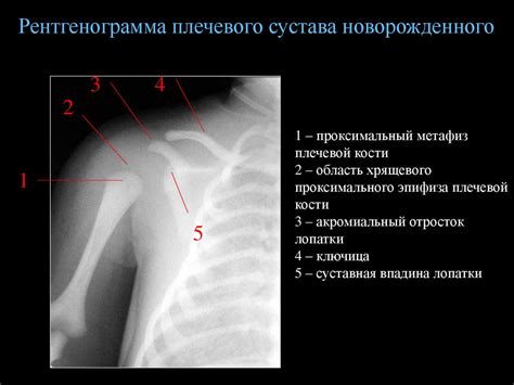Снимок локтевого сустава - презентация онлайн