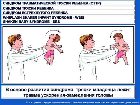 Синдром тряски младенца