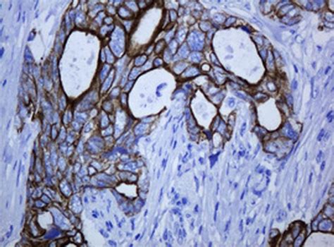 KRT5 Antibody (TA801092)