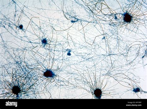 microscopic view  multiple perithecia  fruiting bodies   stock