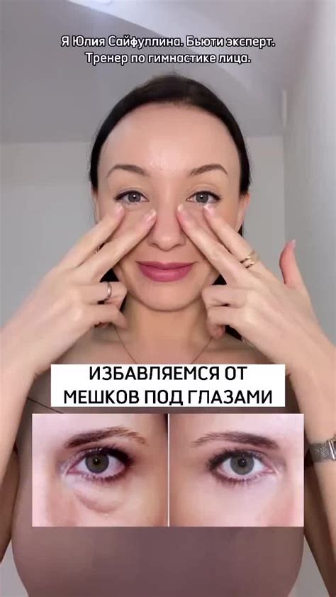 Убираем грыжи под глазами | Fitness