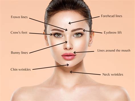 Botox Injection Sites : Forehead Botox Treatment Oxford Leamington ...