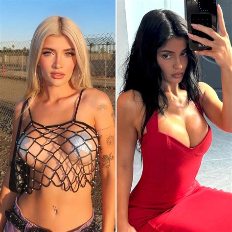 Sami Sheen Reveals Her Exact Breast Augmentation Details 1 Day After