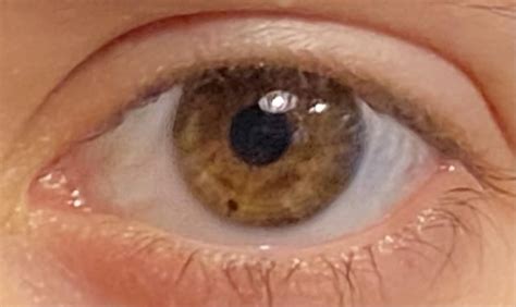 Describe my unique eyes : r/eyes