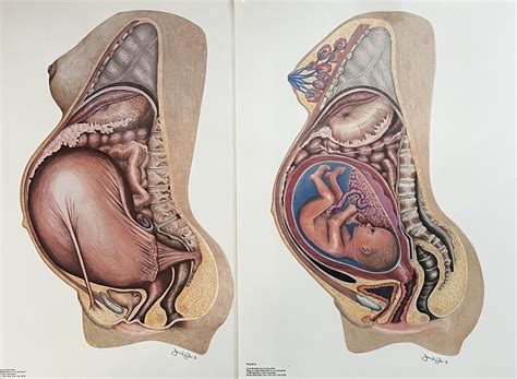 Round Ligament Pregnancy