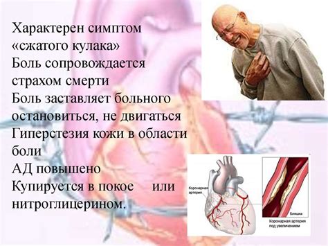 Стенокардия - презентация онлайн