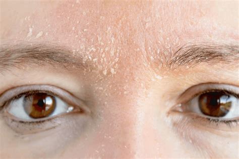 goodbye  dry skin   face tips  tricks  treat