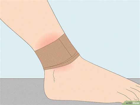 How to Heal a Bruise: First Aid & Remedies for Fast Healing