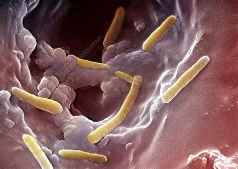 Pseudomonas Aeruginosa - Stock Image - B220/1600 - Science Photo Library