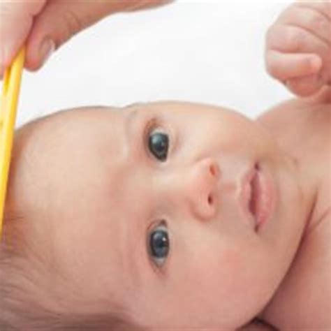Seborrheic Dermatitis Infant Body