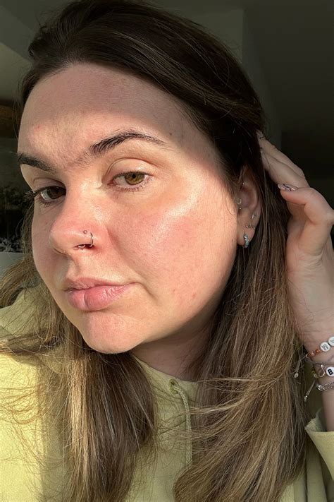 Unbelievable Blackhead Removal 2024: My Honest Review & Before/After Pics. Image 10