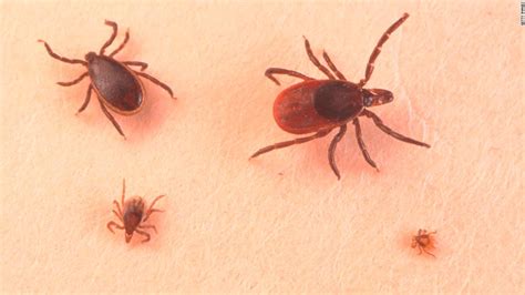 Tick bites: 2 sickened newborns could signal increase in infections - CNN