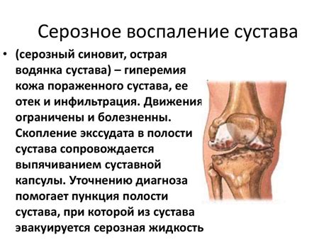Хирургическая инфекция - презентация онлайн