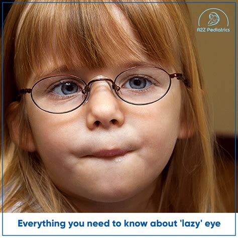 Everything you need to know about 'lazy' eye