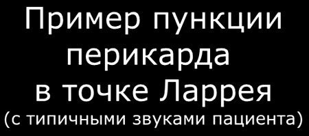 Тампонада сердца (гемотампонада). Первая помощь при гемотампонаде ...