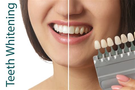 Experience Brighter Smiles: Effective Teeth Whitening Solutions You