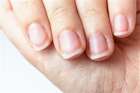 Caring for Your Cuticles: Expert Tips for Healthy Nails