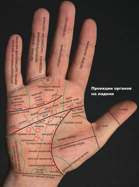 Тромбофлебит на руке фото с расшифровкой