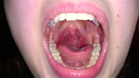 Stretching my uvula and throat. Watch in HD! ;) - YouTube