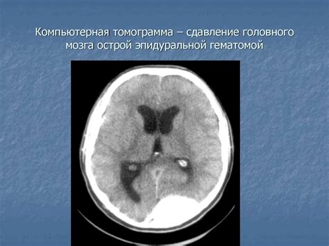 Черепно-мозговая травма - презентация онлайн