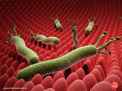 O Que É Bacteria H Pylori - Helicobacter pylori (H. pylori): Sintomas, diagnóstico e tratamento ...